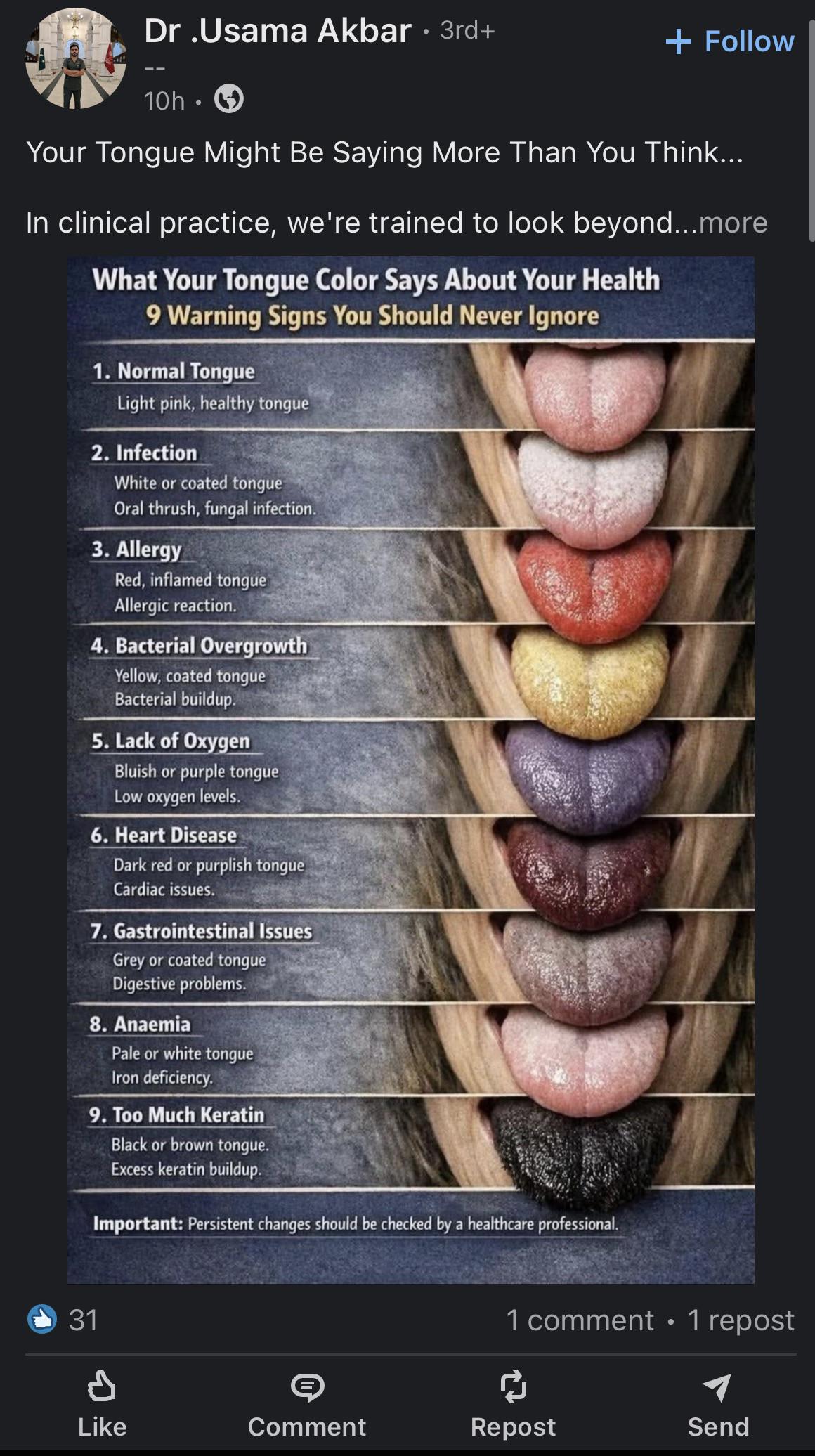 Artificial image of a human tongue, presented on LinkedIn by a user invoking clinical training as credential. Sourced from r/LinkedInLunatics. Forensic analysis indicates stable-diffusion provenance; notable defects include uncanny bilateral symmetry and texture smoothness inconsistent with biological tissue.